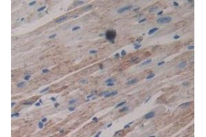 Detection of LAMb3 in Mouse Cardiac Muscle Tissue using Polyclonal Antibody to Laminin Beta 3 (LAMb3)