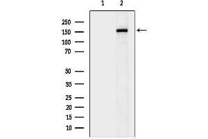 anti-Lysine (K)-Specific Demethylase 5D (KDM5D) (C-Term) antibody