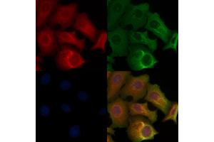 ABIN6260501 and ABIN6268729 staining Hela cells by IF/ICC. (Cathepsin E anticorps  (Internal Region))
