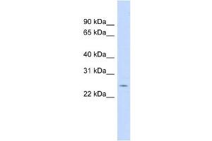 CRP antibody used at 1 ug/ml to detect target protein. (CRP anticorps  (N-Term))