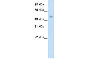 WB Suggested Anti-PTDSR Antibody Titration:  1. (JMJD6 anticorps  (C-Term))