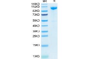 Human CDH17 on Tris-Bis PAGE under reduced condition. (LI Cadherin Protein (AA 23-787) (His tag))
