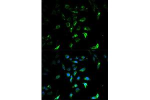 Immunofluorescence analysis of U2OS cells using STAR antibody. (STAR anticorps)