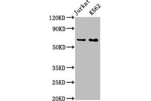 Western Blot Positive WB detected in: Jurkat whole cell lysate, K562 whole cell lysate All lanes: STIP1 antibody at 0. (Recombinant STIP1 anticorps)
