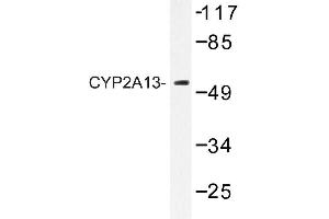 Image no. 1 for anti-Cytochrome P450, Family 2, Subfamily A, Polypeptide 13 (CYP2A13) antibody (ABIN272274) (CYP2A13 anticorps)