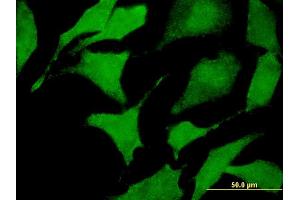 Immunofluorescence of monoclonal antibody to CACNA2D2 on HeLa cell.