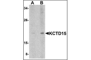 Western blot analysis of KCTD15 in human spleen tissue lysate with this product at (A) 0. (KCTD15 anticorps  (C-Term))