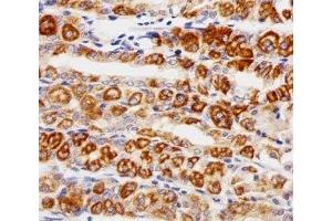 Immunohistochemical analysis of paraffin-embedded human stomach using EGF Receptor antibody at 1:25 dilution.