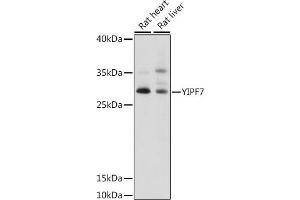 Western blot analysis of extracts of various cell lines, using YIPF7 antibody (ABIN7271420) at 1:1000 dilution. (YIPF7 anticorps  (AA 1-80))