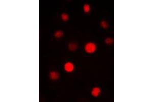 Immunofluorescent analysis of SAP14 staining in HepG2 cells. (Pre-mRNA Branch Site Protein p14 (SF3B14) (C-Term) anticorps)
