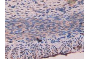 Detection of NUCB2 in Mouse Uterus Tissue using Polyclonal Antibody to Nucleobindin 2 (NUCB2)