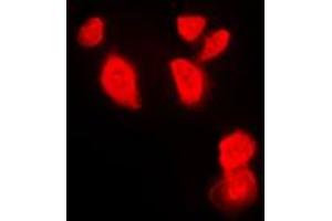 Immunofluorescent analysis of CHK1 staining in HeLa cells.