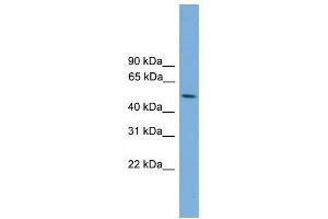 STK38L antibody used at 1 ug/ml to detect target protein. (STK38L anticorps  (Middle Region))