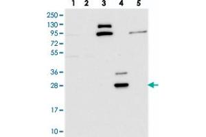 Western blot analysis of Lane 1: RT-4, Lane 2: U-251 MG, Lane 3: Human Plasma, Lane 4: Liver, Lane 5: Tonsil with CYB561D2 polyclonal antibody . (CYB561D2 anticorps)