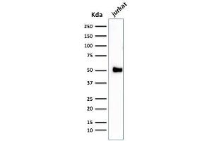 Western Blot Analysis of Jurkat cell lysate using CD2 Mouse Monoclonal Antibody (1E7E8.