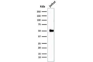 Western Blot Analysis of Jurkat cell lysate using CD2 Mouse Monoclonal Antibody (1E7E8. (CD2 anticorps)