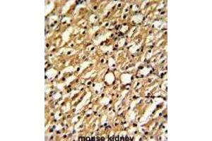 Immunohistochemistry (IHC) image for anti-Dimethylarginine Dimethylaminohydrolase 1 (DDAH1) antibody (ABIN3001702) (DDAH1 anticorps)