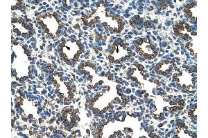RPL8 antibody was used for immunohistochemistry at a concentration of 4-8 ug/ml to stain Alveolar cells (arrows) in Human Lung. (RPL8 anticorps  (C-Term))