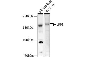 Western blot analysis of extracts of various cell lines, using LRP5 antibody (ABIN1513164, ABIN3020644, ABIN3020646 and ABIN6213630) at 1:500 dilution. (LRP5 anticorps  (AA 1000-1250))