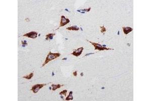 Immunohistochemical analysis of paraffin-embedded human brain section using RPS6 antibody at 1:25 dilution.