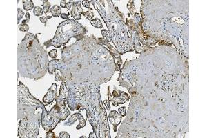 IHC analysis of RAB1B using anti-RAB1B antibody (ABIN7602809). (RAB1B anticorps  (C-Term))