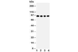 Western blot testing of ADAM17 antibody and Lane 1:  human placenta (ADAM17 anticorps  (C-Term))
