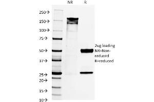 SDS-PAGE Analysis Purified PAX8 Mouse Monoclonal Antibody (PAX8/1492).