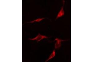 ABIN6275848 staining  HepG2 cells by IF/ICC. (MASTL anticorps  (C-Term))