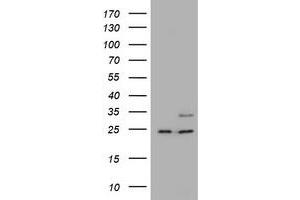 Image no. 1 for anti-RAB21, Member RAS Oncogene Family (RAB21) antibody (ABIN1500549) (RAB21 anticorps)