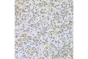 Immunohistochemistry of paraffin-embedded mouse lung using HMGB1 Antibody. (HMGB1 anticorps  (AA 100-200))