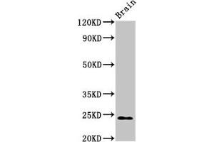 Western Blot Positive WB detected in: Rat brain tissue All lanes: NDUFS8 antibody at 2.