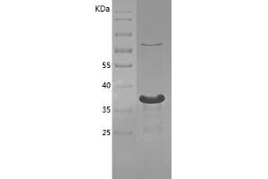 Western Blotting (WB) image for YY1 Transcription Factor (YY1) (AA 35-146) protein (His tag) (ABIN7125762)