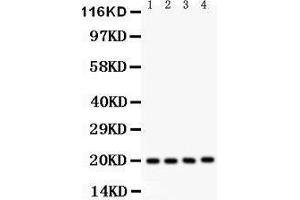 Western Blotting (WB) image for anti-Parkinson Protein 7 (PARK7) (AA 2-189) antibody (ABIN3043589)