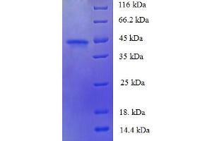 SDS-PAGE (SDS) image for Family with Sequence Similarity 110, Member B (FAM110B) (AA 1-370), (full length) protein (His tag) (ABIN5709495)