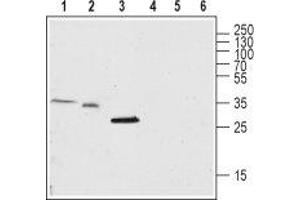Western blot analysis of rat brain lysate (lanes 1 and 4), and mouse brain membrane (lanes 2 and 5) and skeletal muscle (lanes 3 and 6): - 1-3. (TMEM38A anticorps  (C-Term, Intracellular))
