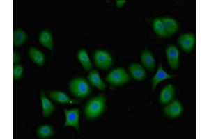 Immunofluorescent analysis of A549 cells using ABIN7163201 at dilution of 1:100 and Alexa Fluor 488-congugated AffiniPure Goat Anti-Rabbit IgG(H+L) (PIP4K2B anticorps  (AA 1-270))