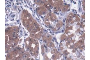 DAB staining on IHC-P; Samples: Human Stomach Tissue (Metaxin 1 anticorps  (AA 175-387))
