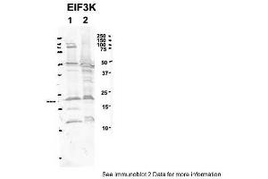 Sample Type: 1. (EIF3K anticorps  (C-Term))