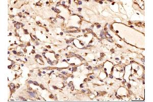 IHC analysis of AASS using anti-AASS antibody (ABIN7601519).