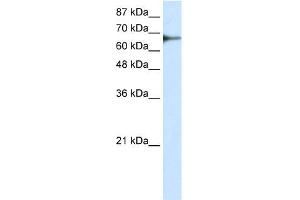 WB Suggested Anti-L3MBTL2 Antibody Titration: 0. (L3MBTL2 anticorps  (C-Term))