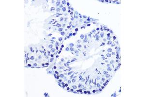 Immunohistochemistry of paraffin-embedded mouse testis using Phospho-SMC1-S957 Rabbit mAb (ABIN7270613) at dilution of 1:100 (40x lens). (SMC1A anticorps  (pSer957))
