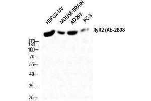 Western Blotting (WB) image for anti-Ryanodine Receptor 2 (Cardiac) (RYR2) (Tyr1018) antibody (ABIN3177320) (RYR2 anticorps  (Tyr1018))