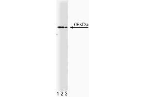 Western blot analysis of PTP1C on Jurkat cell lysate. (SHP1 anticorps  (AA 492-597))