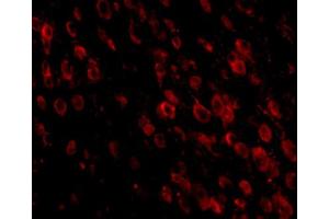 Immunofluorescent staining of mouse brain tissue with Pdcd1 monoclonal antibody, clone 7A11B1  at 20 ug/mL.