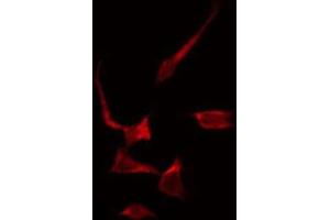 ABIN6266882 staining COLO205 by IF/ICC.