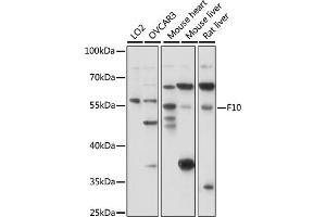 Western blot analysis of extracts of various cell lines, using F10 antibody (ABIN7266422) at 1:1000 dilution.