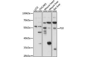 Western blot analysis of extracts of various cell lines, using F10 antibody (ABIN7266422) at 1:1000 dilution. (Coagulation Factor X anticorps  (AA 41-300))