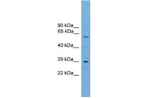WB Suggested Anti-RPAIN Antibody Titration:  0. (RPAIN anticorps  (C-Term))