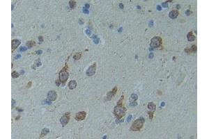 Detection of SMAD9 in Human Cerebrum Tissue using Polyclonal Antibody to SMAD family member 9 (SMAD9)