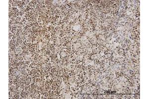 Image no. 1 for anti-Tankyrase, TRF1-Interacting Ankyrin-Related ADP-Ribose Polymerase (TNKS) (AA 1017-1125) antibody (ABIN599052) (TNKS anticorps  (AA 1017-1125))